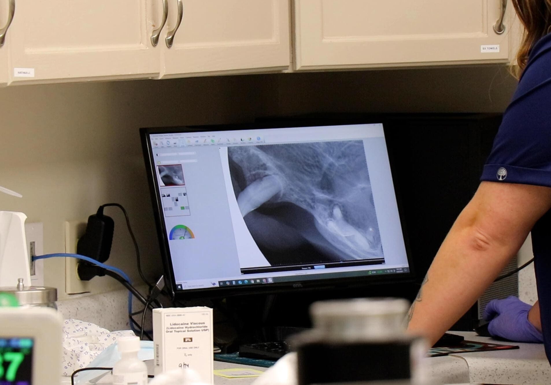 Veterinarian Looking At Dental Xrays On Computer